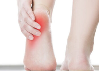 Unexpected Reasons Your Heels Are So Red