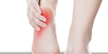 Unexpected Reasons Your Heels Are So Red